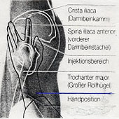 Ventroglutal